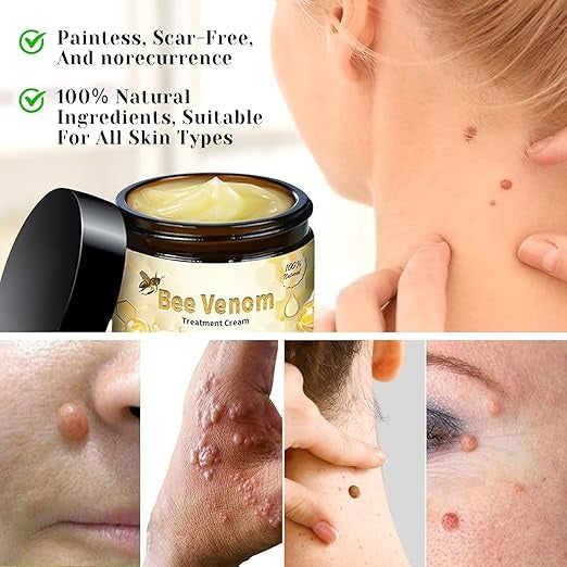 Bee Venom Cream for All Body Parts