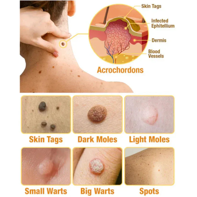 Bee Venom Tag Remover and Skin Repair Spray
